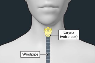 Diagram of the throat with labels showing the larynx and windpipe. The larynx is highlighted to show it can be affected by laryngeal cancer.