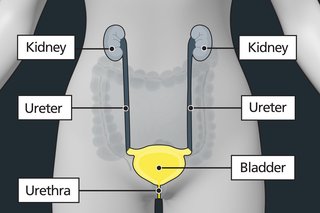 Diagram of the tummy area of a female with labels showing the bladder, ureters, urethra and kidneys. The bladder is highlighted to show it can be affected by bladder cancer.