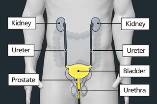 Diagram of the tummy area of a male with labels showing the bladder, prostate, ureters, urethra and kidneys. The bladder is highlighted to show it can be affected by bladder cancer.